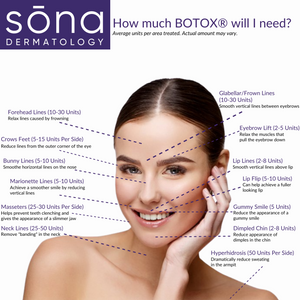 BOTOX® By The Unit (Service)